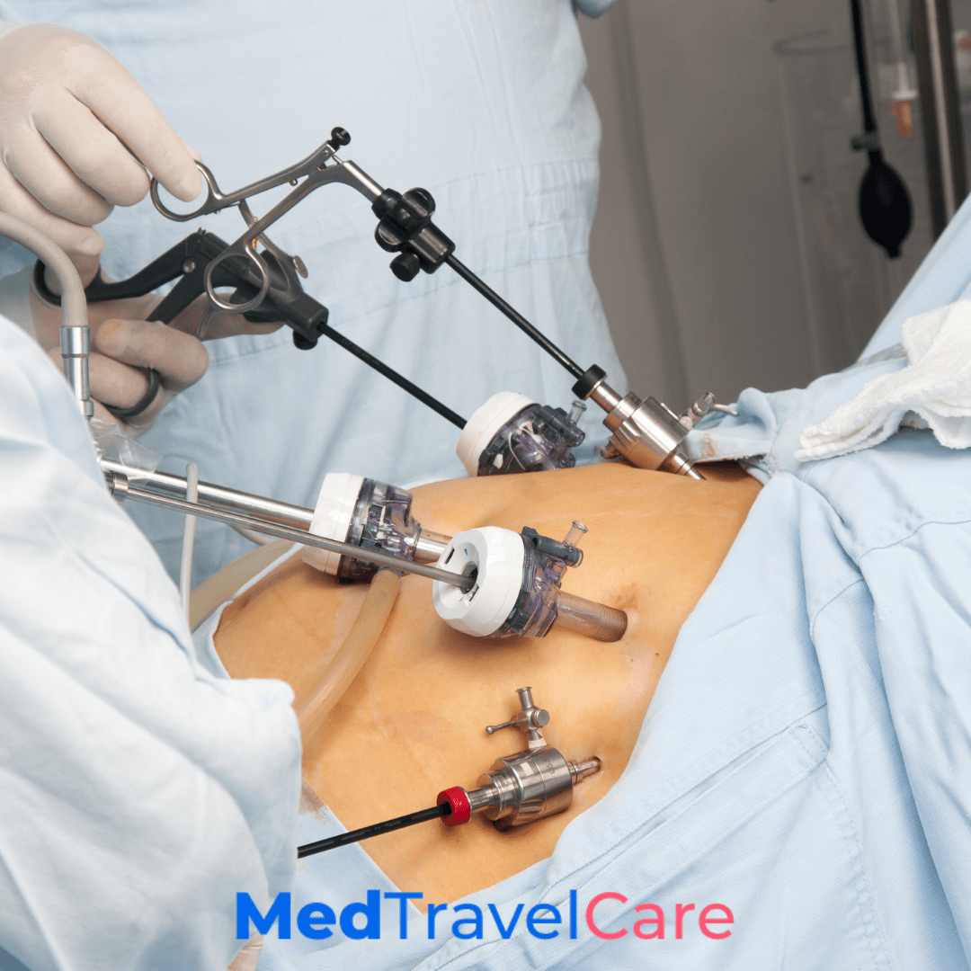 Gastric Bypass Surgery in Turkey